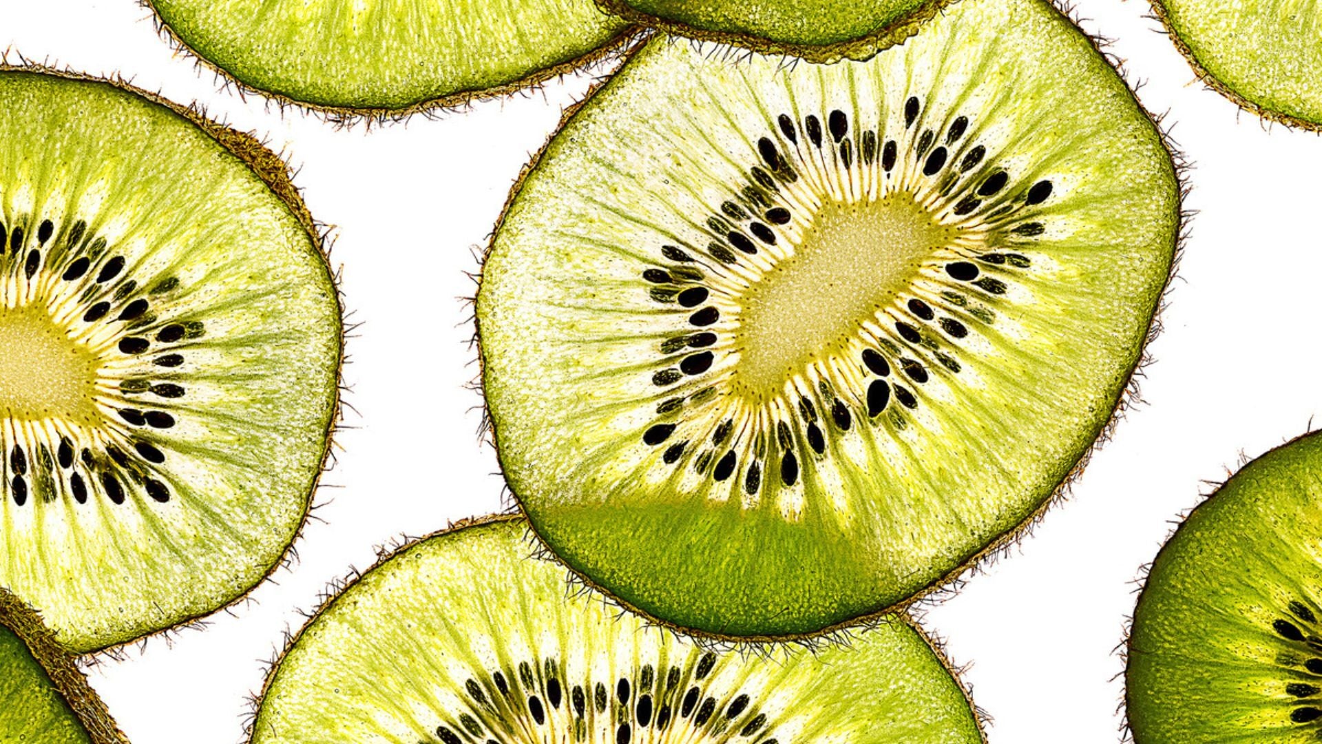 Vitamin Deficiency and Hair Loss