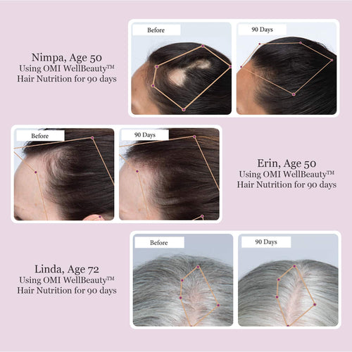 OMI Hair Nutrition - image 2