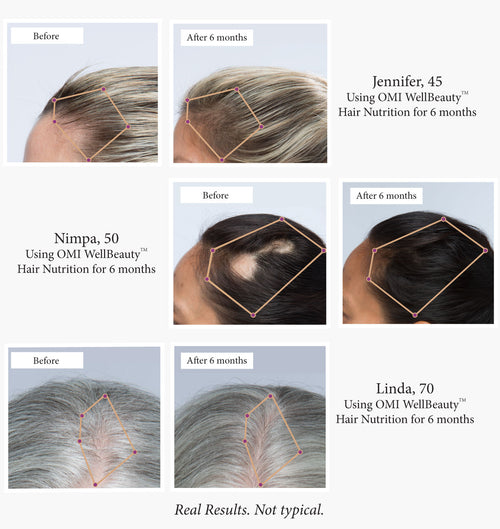 Hair Nutrition - image 2